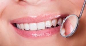 Cauze ale modificarii de culoare a dintilor