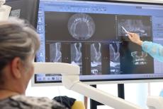 Implantul dentar pas cu pas: ce conteaza pentru un rezultat stabil si functional pe termen lung