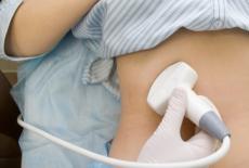 Reguli ce trebuie respectate inainte de efectuarea unei ecografii