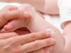 Eczema bebelusilor: informatii si recomandari