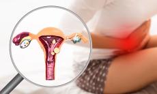 Endometrioza la adolescente