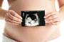 Incompatibilitatea materno - fetala in sistemul Rhesus (Rh)