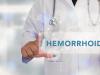 Hemoroizii: tratament vs creme