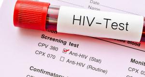 HIV si SIDA: care este legatura?