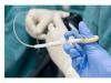 Interventii chirurgicale endoscopice Europa de Vest 60-80% - Romania 30%