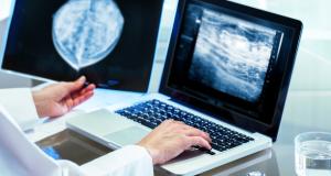 Ce alternative ale mamografiei sunt disponibile si cum functioneaza?