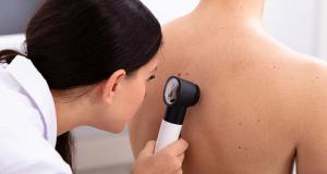 Melanomul poate fi prevenit?