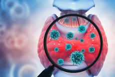 Tumorile neuroendocrine