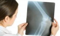 20 octombrie - Ziua Internationala a Osteoporozei