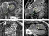 Cardio-RM-ul, cea mai complexa investigatie dedicata inimii si aplicatiile sale pentru pacientii din Romania