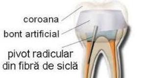 Pivotii de fibra de sticla