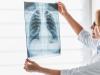 Cand se realizeaza transplantul pulmonar?