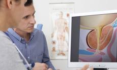 Prostata marita sau adenomul de prostata