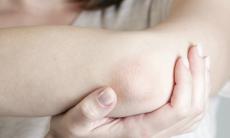 Totul despre scabie (raie)