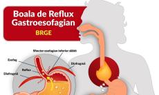 Refluxul gastric si boala de reflux