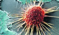 Moartea celulelor canceroase prin mecanismul enzimei CYP1B1 