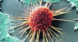 Moartea celulelor canceroase prin mecanismul enzimei CYP1B1 