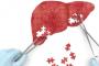 Protectie si regenerare hepatica direct din natura