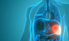 Splenomegalia sau marirea splinei - cauze, simptome, tratament