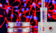 Recoltarea celulelor stem la nastere: oportunitate biologica pentru sanatatea copilului