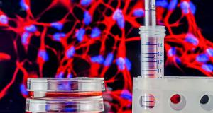 Recoltarea celulelor stem la nastere: oportunitate biologica pentru sanatatea copilului