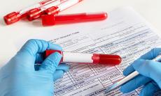 Hemoglobina glicozilata (HbA1C) in diabetul zaharat