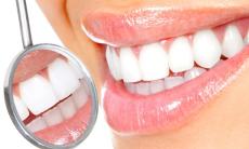 Factori mai putini cunoscuti care determina ingalbenirea dintilor