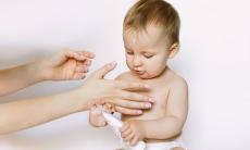 Tot ce trebuie stiut despre urticaria la copii