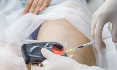 Scleroterapia & ozonoterapia – mix-ul imbatabil impotriva varicelor