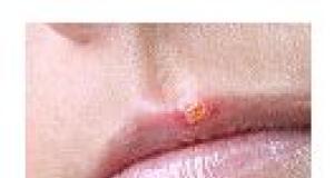 Virusul herpes simplex