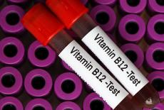 Anemia prin deficit de vitamina B12 (Anemia pernicioasa)