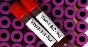 Anemia prin deficit de vitamina B12 (Anemia pernicioasa)