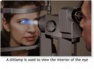 LASER ZEISS VISULAS  YAG III