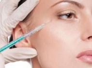 Injectare toxina botulinica