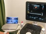 Ecograf Doppler Clear Vue 550 iScan type